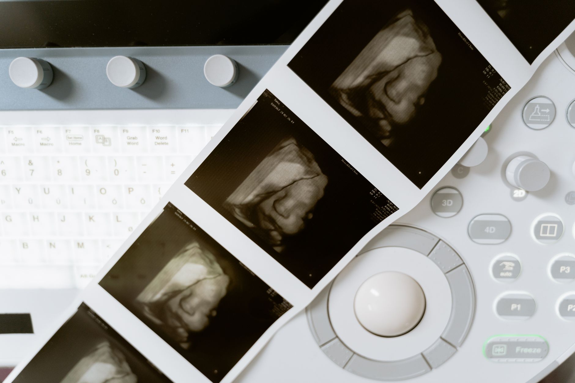 a modern fertility clinic interior with softly lit examination equipment, ultrasound machines, and wall-mounted digital displays showing health data dashboards