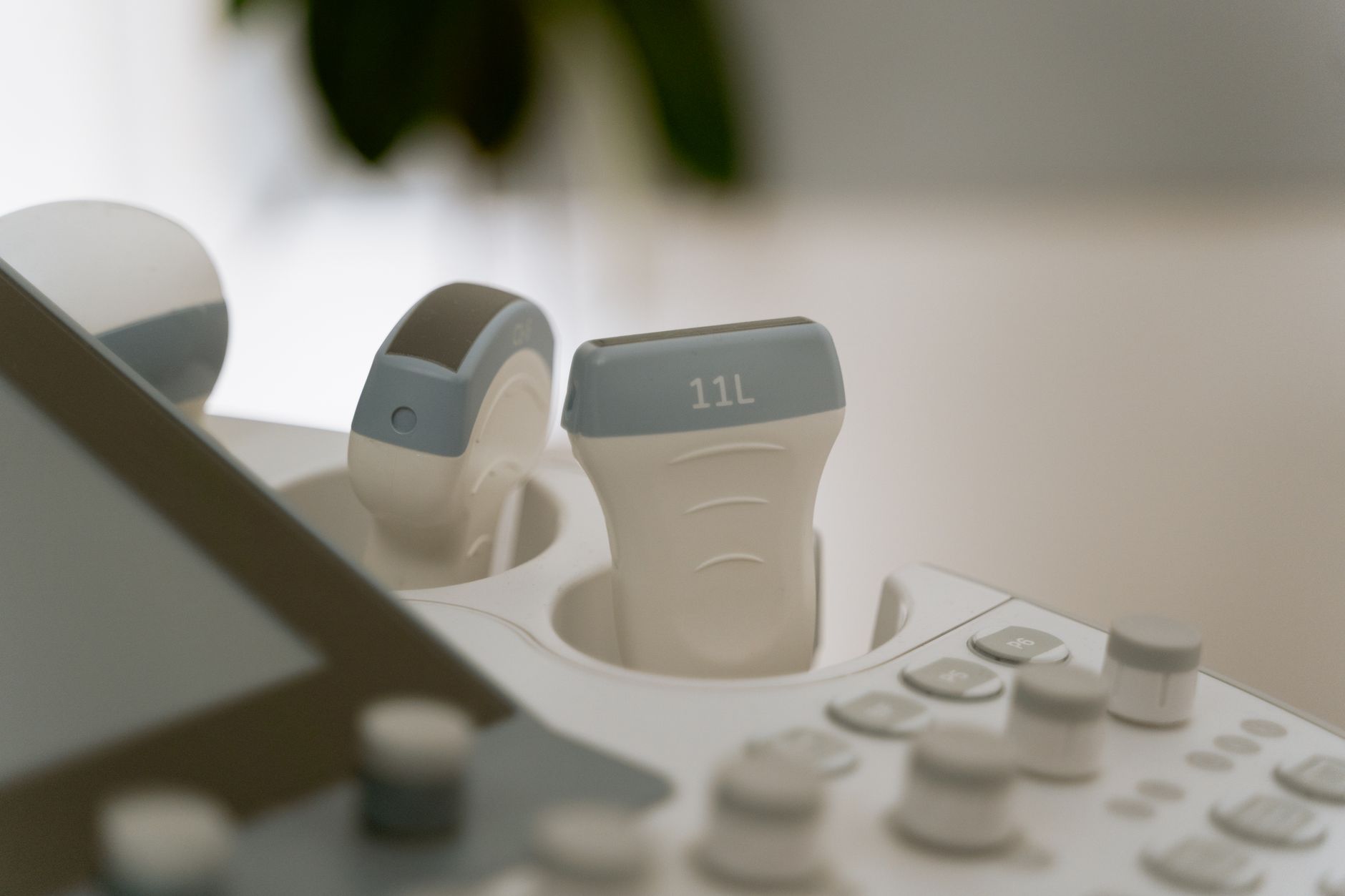 a compact handheld ultrasound probe resting on a clinical surface beside a smartphone displaying a fetal scan interface