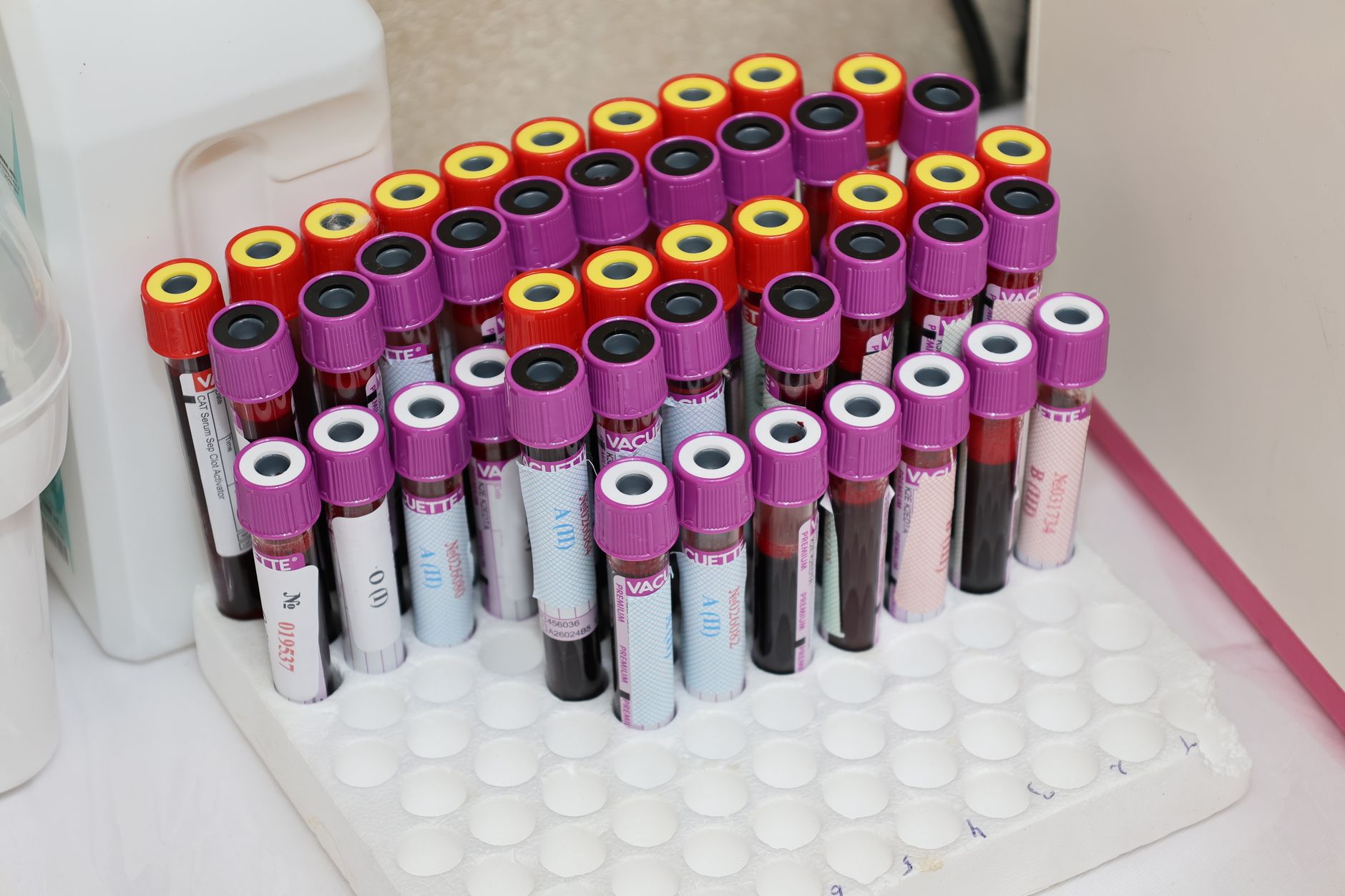 a clinical research laboratory with specialized medical imaging equipment and illuminated specimen storage units along one wall